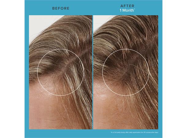 Living Proof Scalp Care Revitalizing Treatment